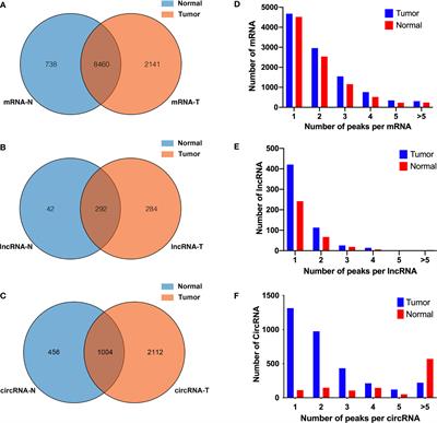 Transcriptome-Wide Map of N6-Methyladenosine Methylome Profiling in Human Bladder Cancer